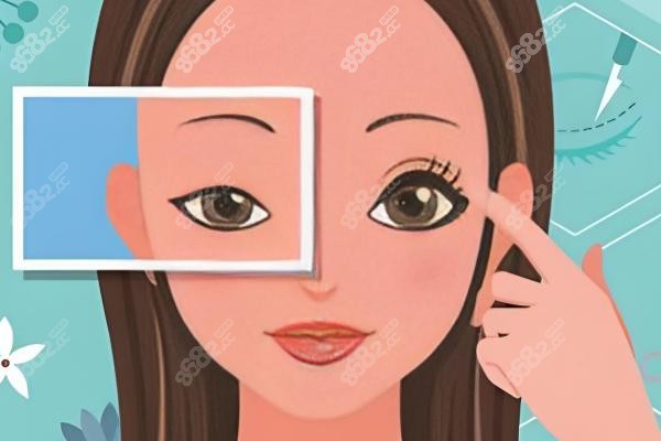 上海鄭小紅醫(yī)生,眼部整形,2025年價目表,雙眼皮手術(shù),雙眼皮修復(fù)手術(shù),眼綜合項目,去眼袋項目,初眼手術(shù),修復(fù)手術(shù),價格優(yōu)勢,優(yōu)惠