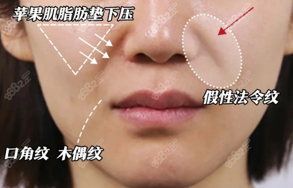 法国春天带提升成效叠加有多牛