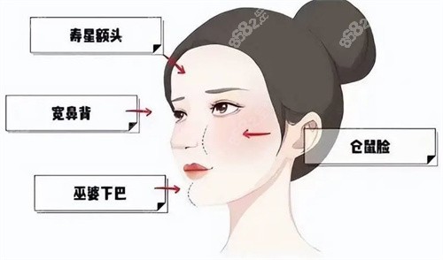 上海生长因子馒化哪位医生做的好？曾德浩/沈国雄/安洪宾清异物技术并列