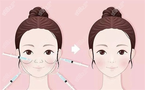 馒化脸修复前后