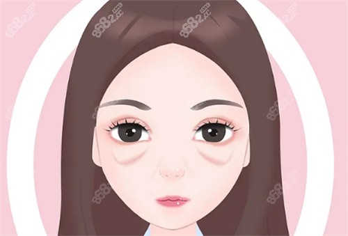眼袋图
