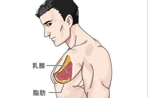 睪丸切除術(shù),臥床時間,泰國曼谷雨整形醫(yī)院,陰道再造技術(shù),術(shù)后注意事項