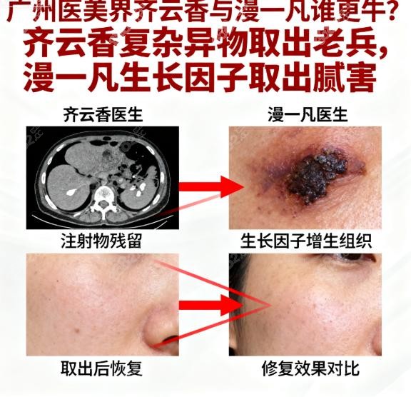 漫一凡：生长因子异常增生的"侦探" & 面部精修大师