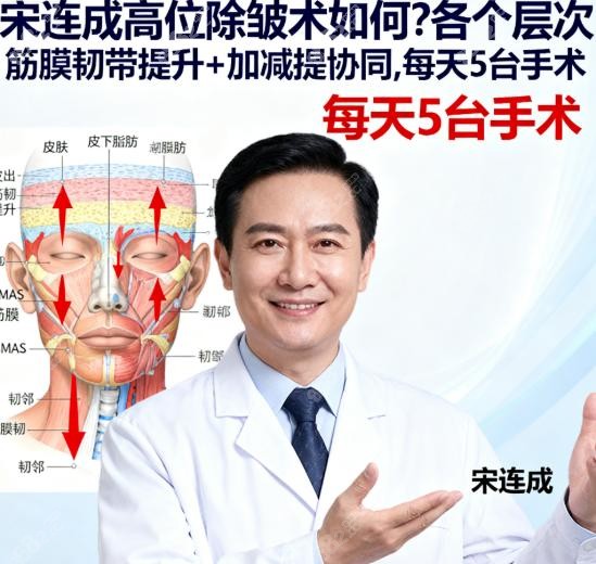 宋連成高位除皺術(shù)如何?各個(gè)層次筋膜韌帶提升+加減提協(xié)同,每天5臺(tái)手術(shù)