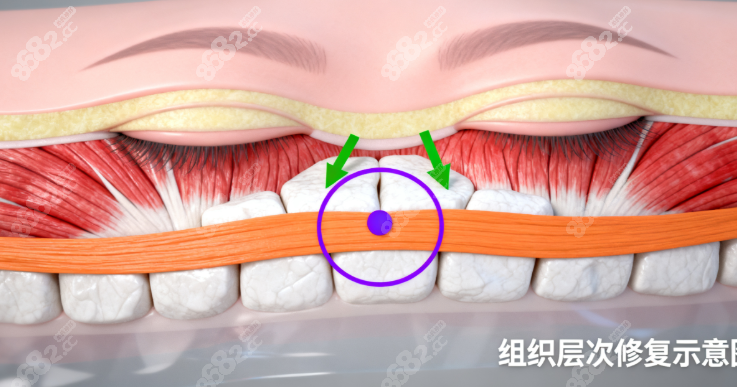 韓國雙眼皮修復拒絕黑名單