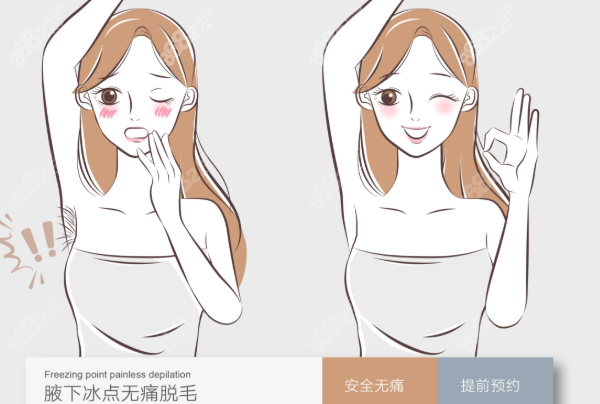 四、激光脫毛術(shù)后護(hù)理要點(diǎn)科普