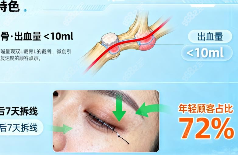 柳超：推颧骨不（错）的灵活高手