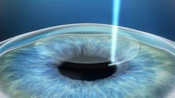 王乐今在北京熙仁眼科医院坐诊，多渠道轻松预约王乐今做后巩膜加固术！