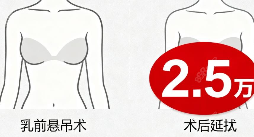 重庆胸部提升手术多少钱？这些因素会让价格有波动