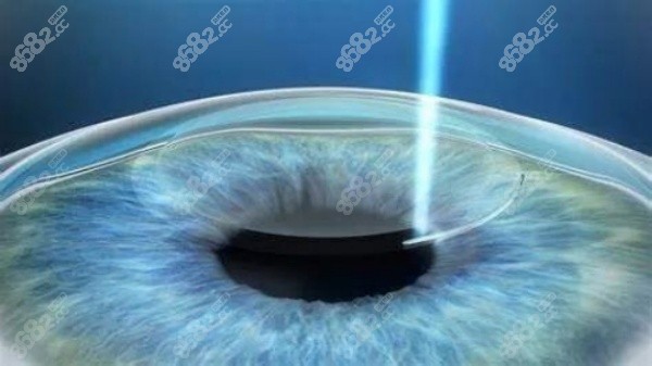 王乐今在北京熙仁眼科医院坐诊