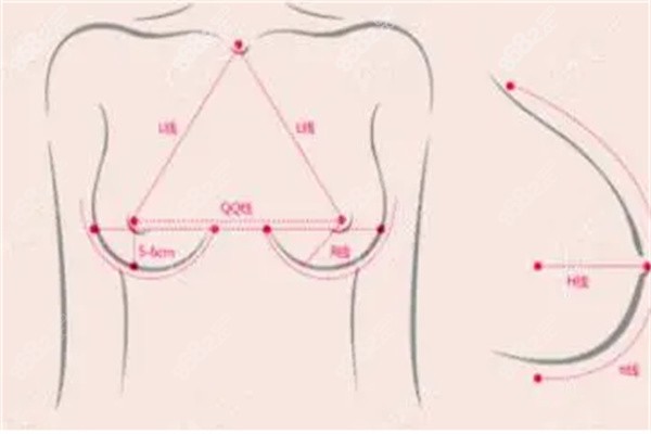 男生可以做隆胸嗎？隆胸大小及手術(shù)類(lèi)型全知曉