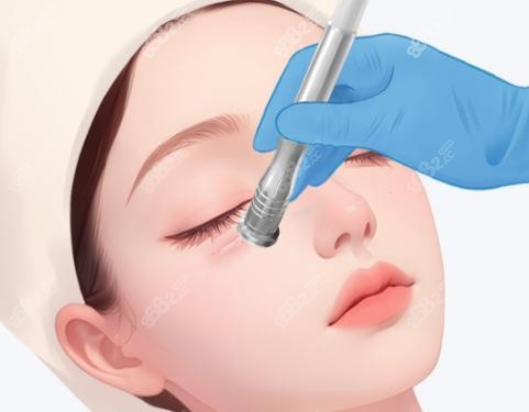 深圳朱冠峰祛眼袋外地患者專屬：貼心服務讓異地就醫(yī)無憂