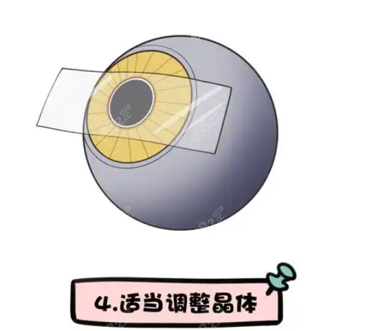 汉中晶体植入手术常见问题解答