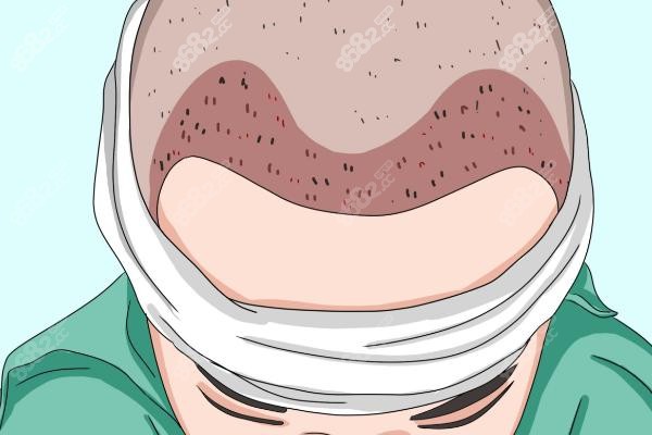 臨沂華美醫(yī)學(xué)養(yǎng)護(hù)項(xiàng)目價(jià)格