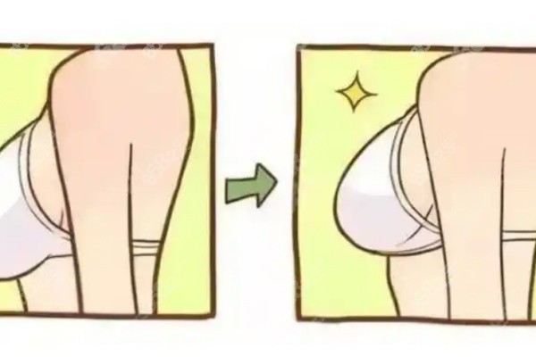 男生可以做隆胸嗎？不同情況適用手術(shù)詳細(xì)說(shuō)明