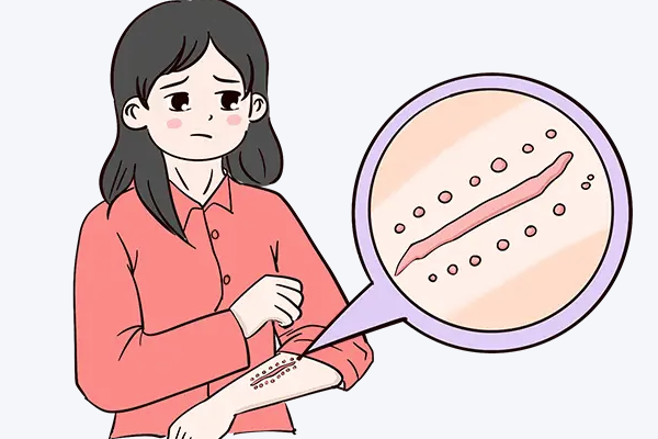 吉大一院疤痕修复价格贵吗？林泉、赵自然医生技术解析+费用明细