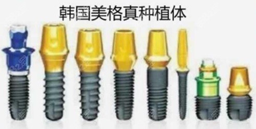 种植牙 美格真.jpg