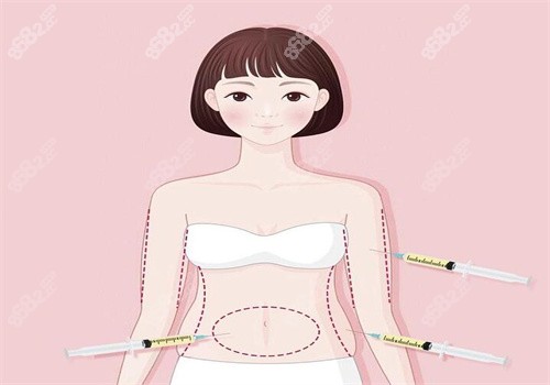 上海袁玉坤面部脂肪填充