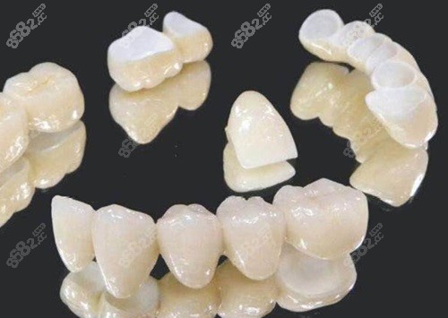 牙冠 全瓷牙冠.jpg
