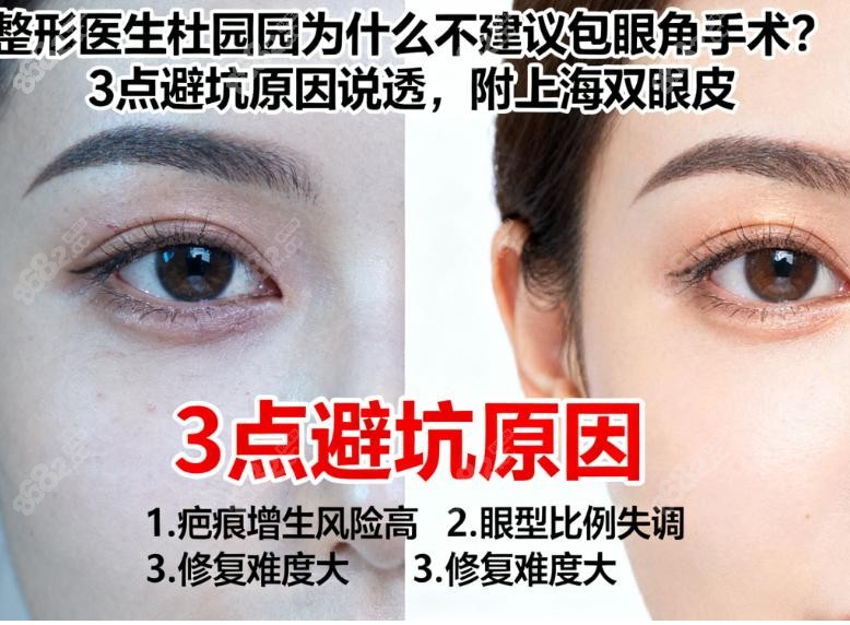 杜园园不建议包眼角手术的原因3