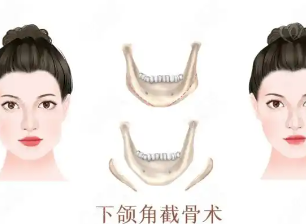 苏敬达做大脚骨手术的医院是哪家？北京圣嘉新医疗美容医院值得关注
