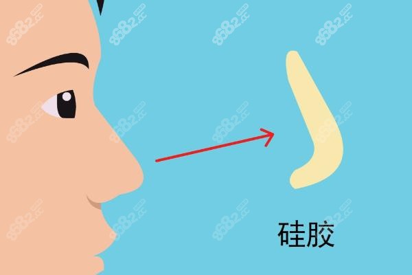 从术前设计到术后护理，范荣杰的“数字化隆鼻体验”到底多丝滑？