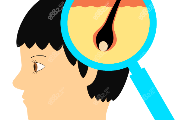 碧蓮盛植發(fā)不同類型植發(fā)技術(shù)多少錢？