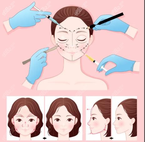 張晉寶做不開(kāi)刀眼袋靠譜嗎？