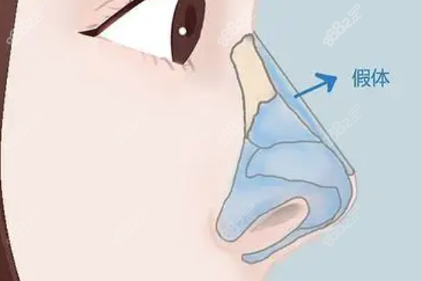 87ba6721ef55c277483fff94037f6f1.png