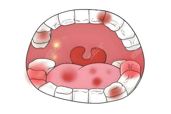 北京德固口腔診所再生牙多少錢？價格大揭秘