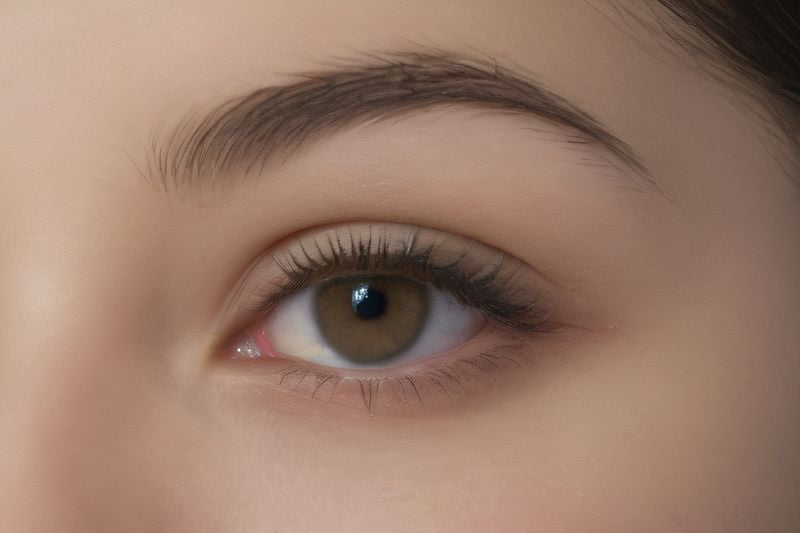 牽?；ňC合征治療之手術(shù)干預(yù)