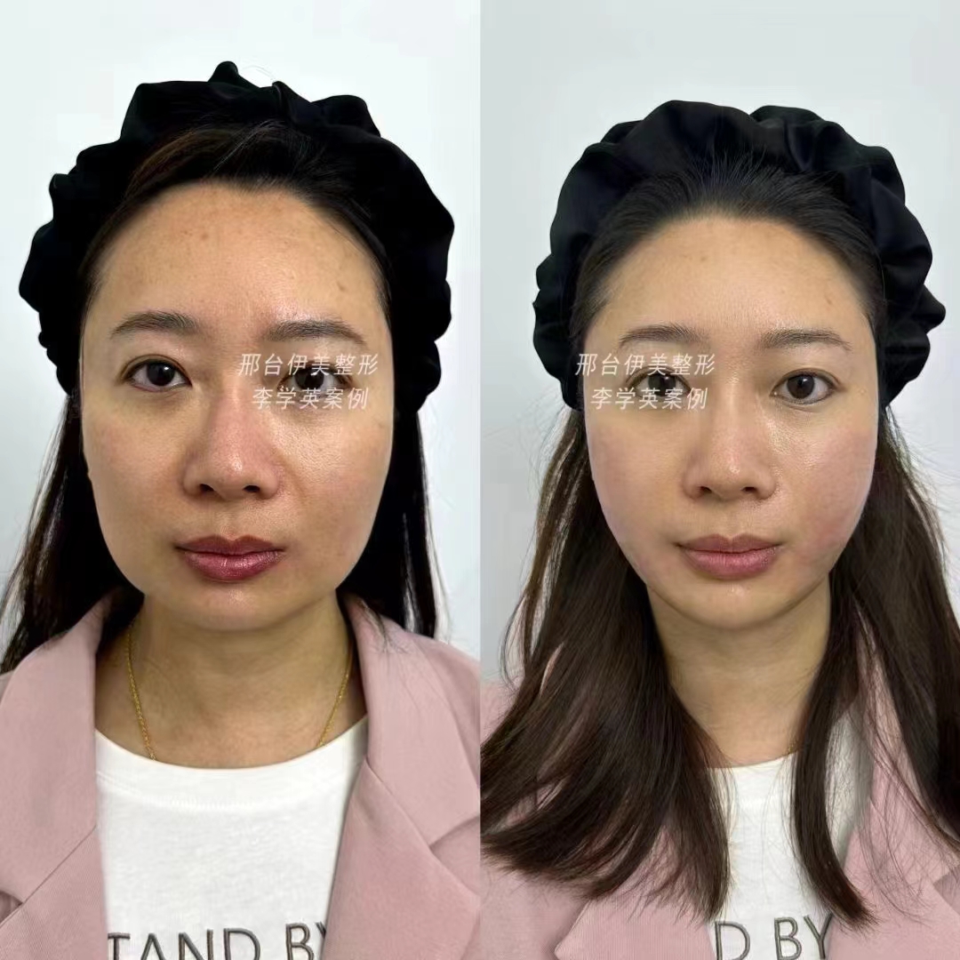 二、深圳艺星医疗美容医院汤洪波医生简介