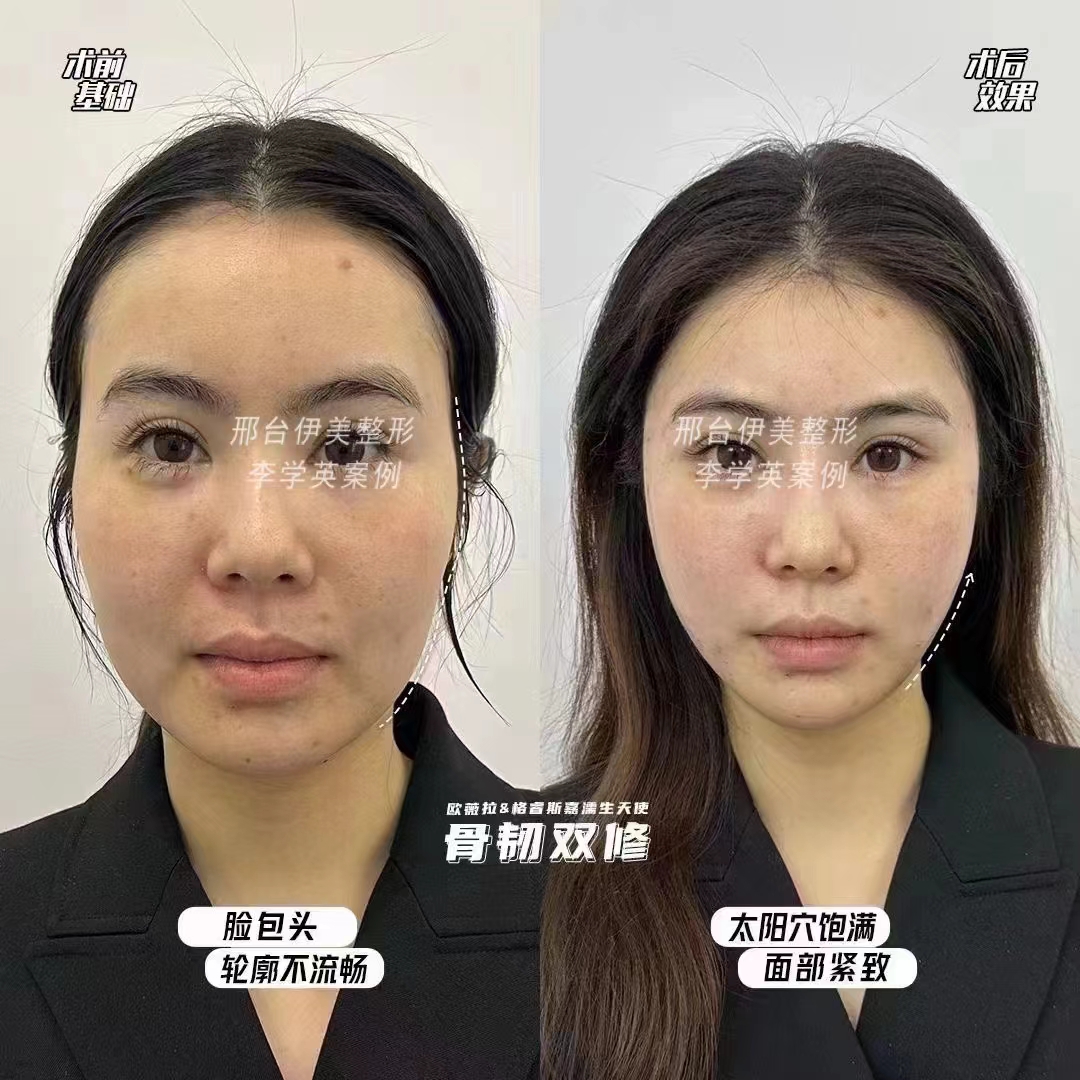 四、深圳艺星医疗美容医院介绍