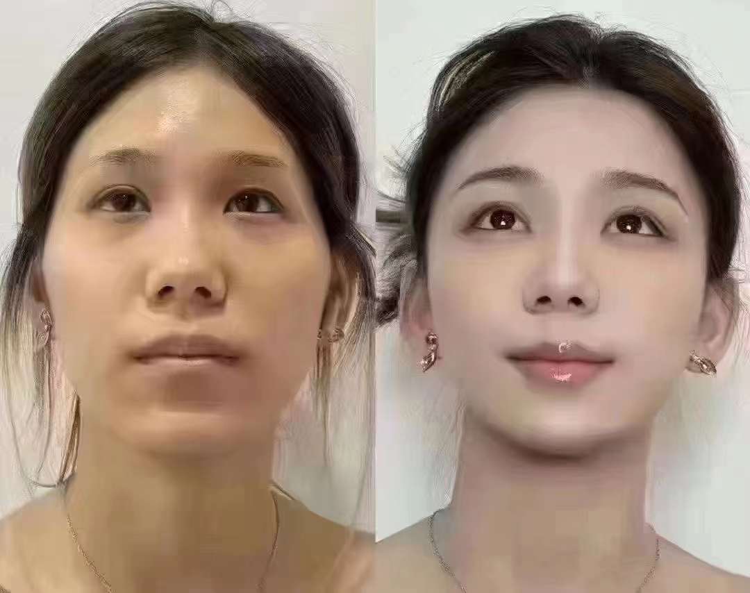 三、蒲翠玲医生擅长技术及优势