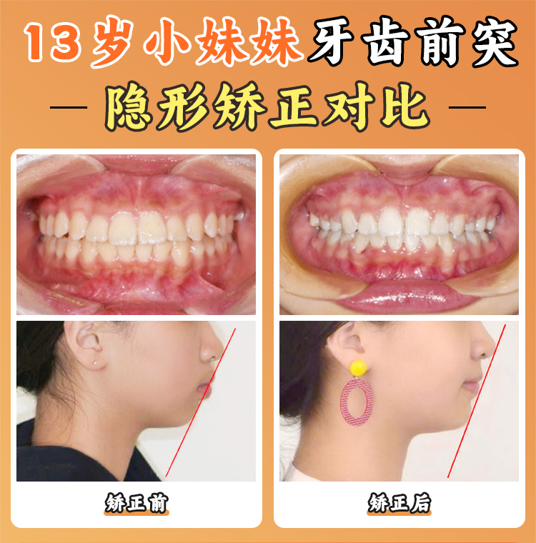 肇庆爱顿口腔价格贵不贵?