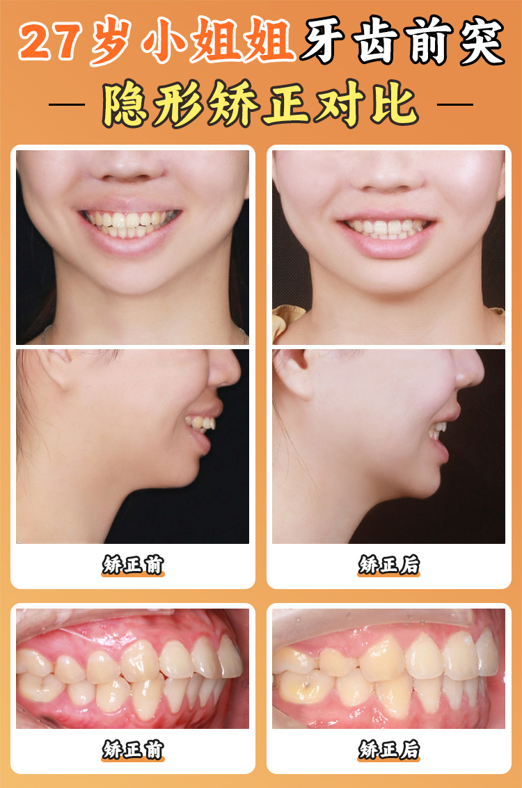 肇庆爱顿口腔口碑好不好?