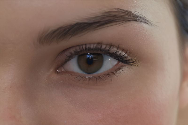 上海喬彤醫(yī)生后鞏膜加固術多少錢？2025年全新收費標準曝光！