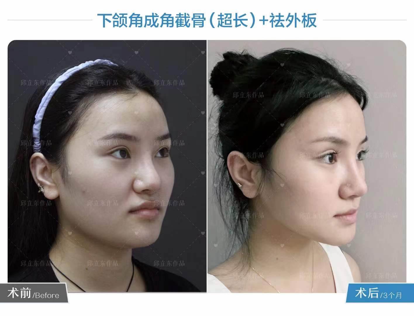 二、籍建華醫(yī)生的三大絕活，鑄就口碑傳奇