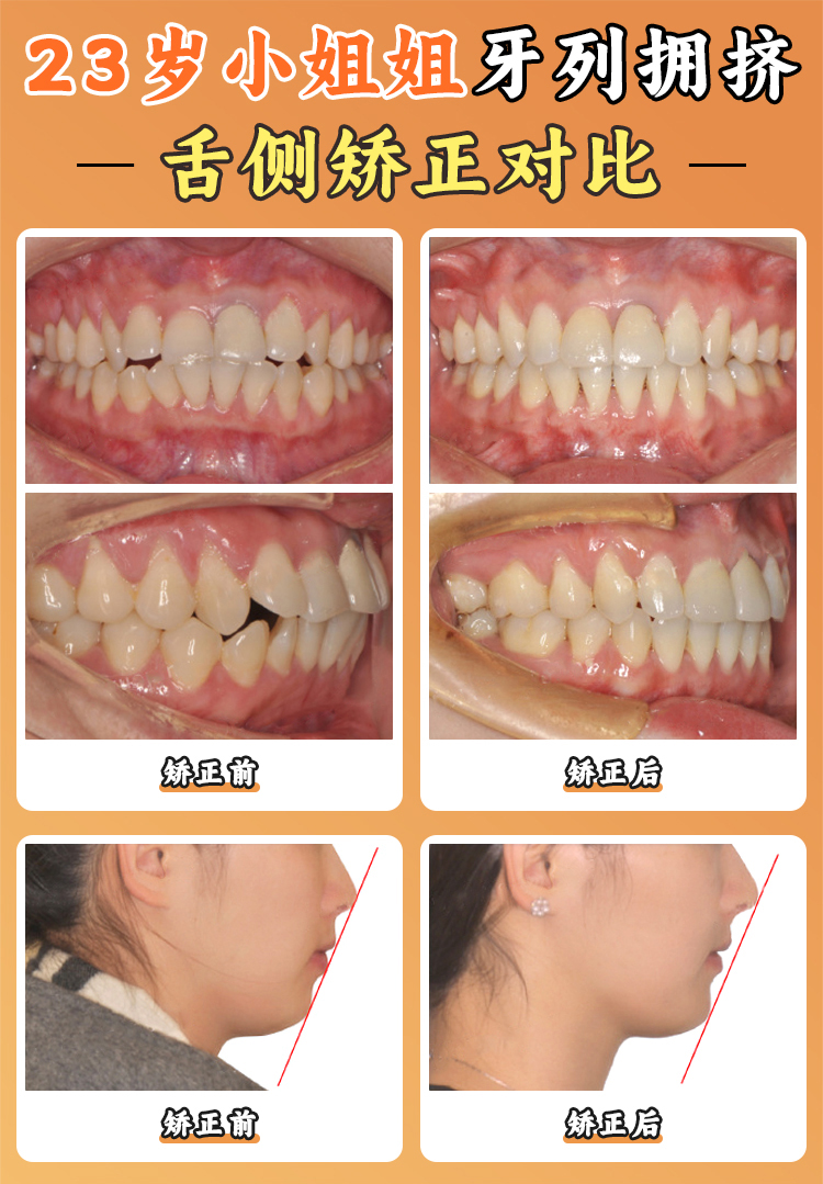 珠海固得口腔到底牛在哪？主打技術(shù)和醫(yī)生實(shí)力一次說(shuō)清
