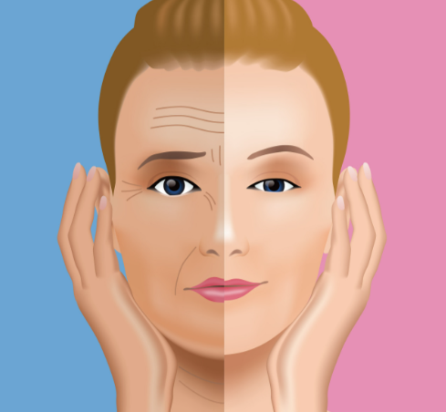 王洪拉皮術(shù)后