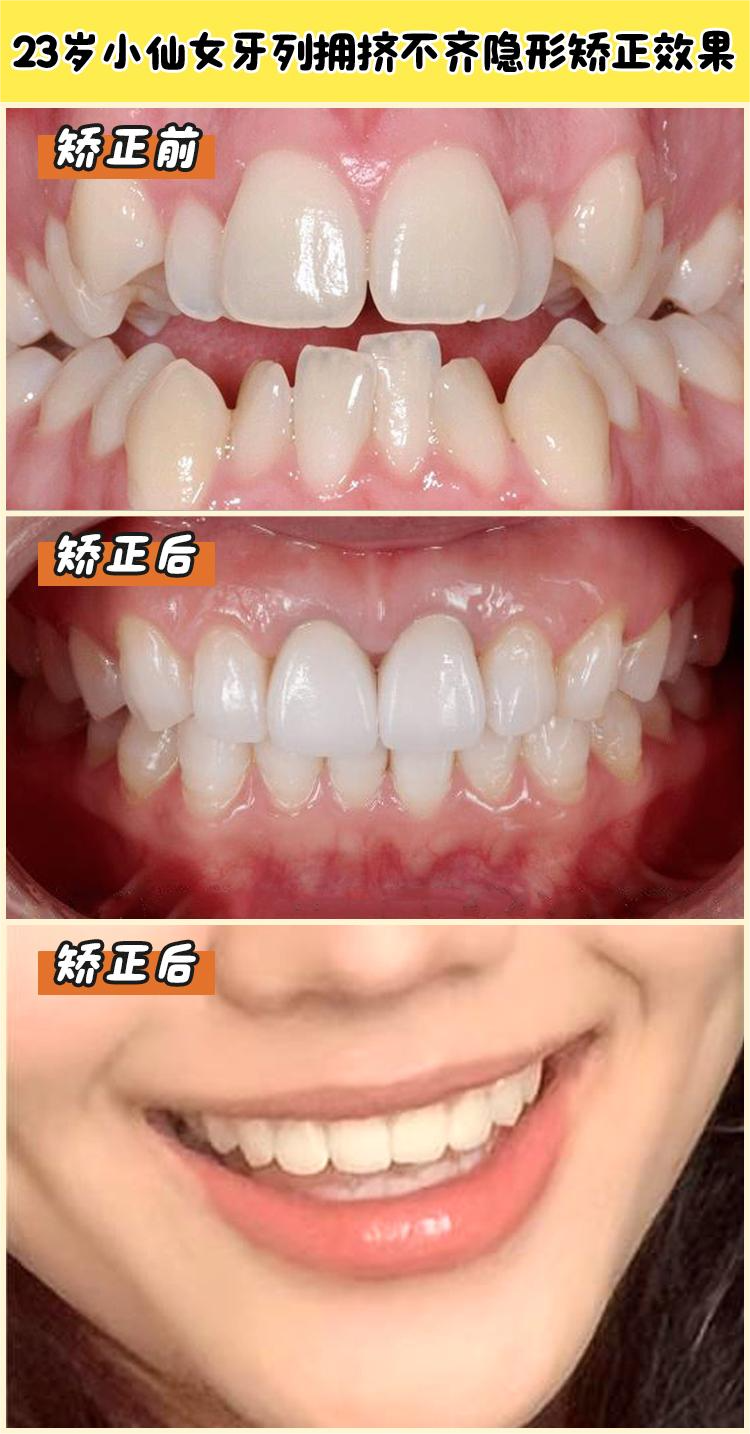 周彥恒簡介來啦！想曉其年齡籍貫，看他在骨性錯頜非手術(shù)矯治等正畸技術(shù)上究竟多牛？