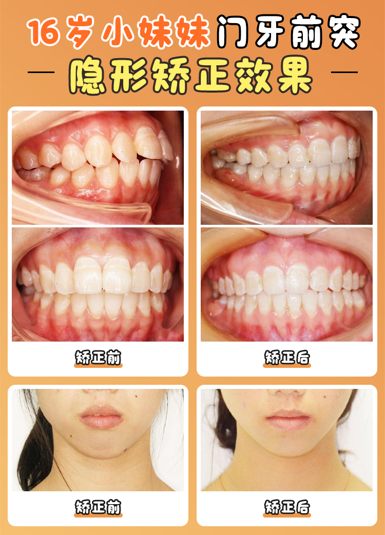 二、张栋梁医生组合矫正项目价格表