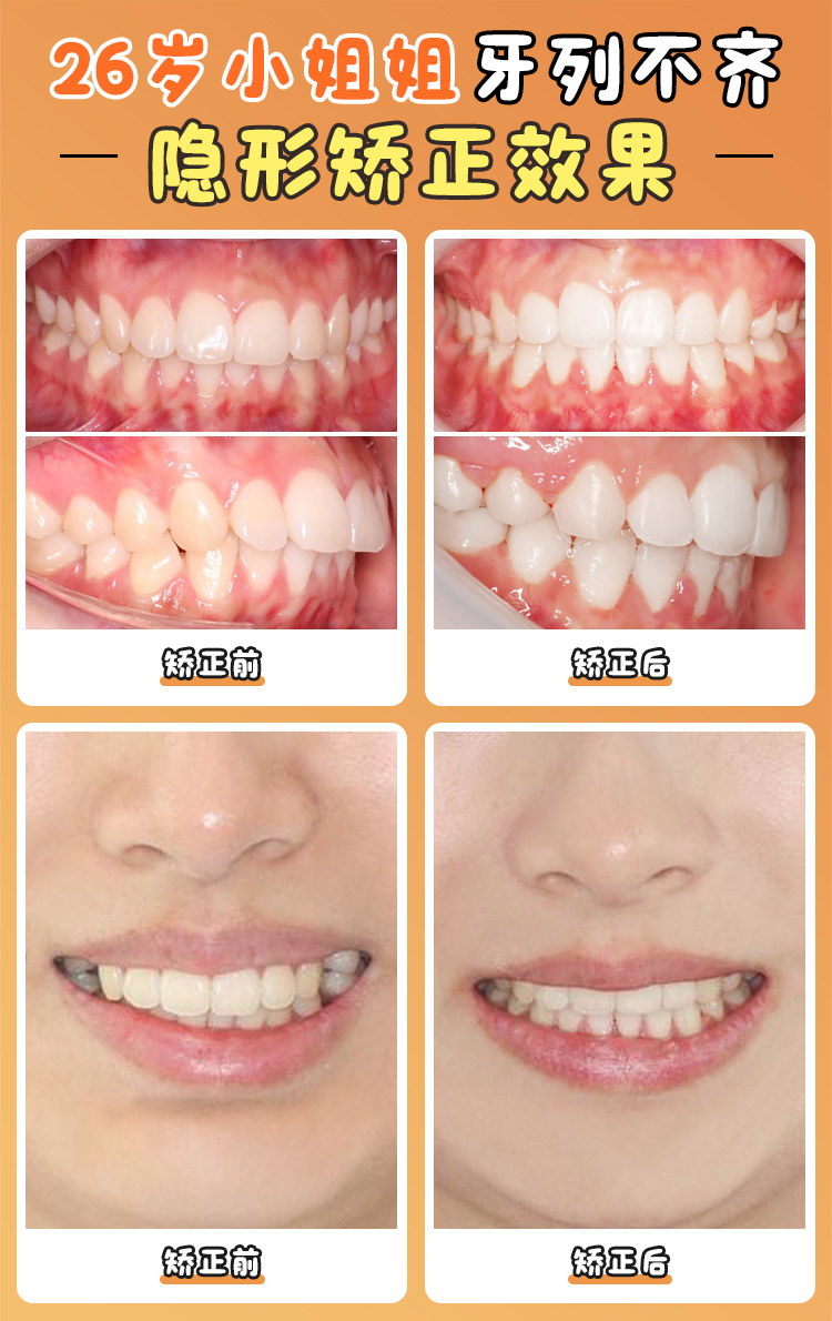 贾培增正畸医生看牙怎么样？探秘舌侧隐形矫正等特色技术与便捷预约坐诊详情