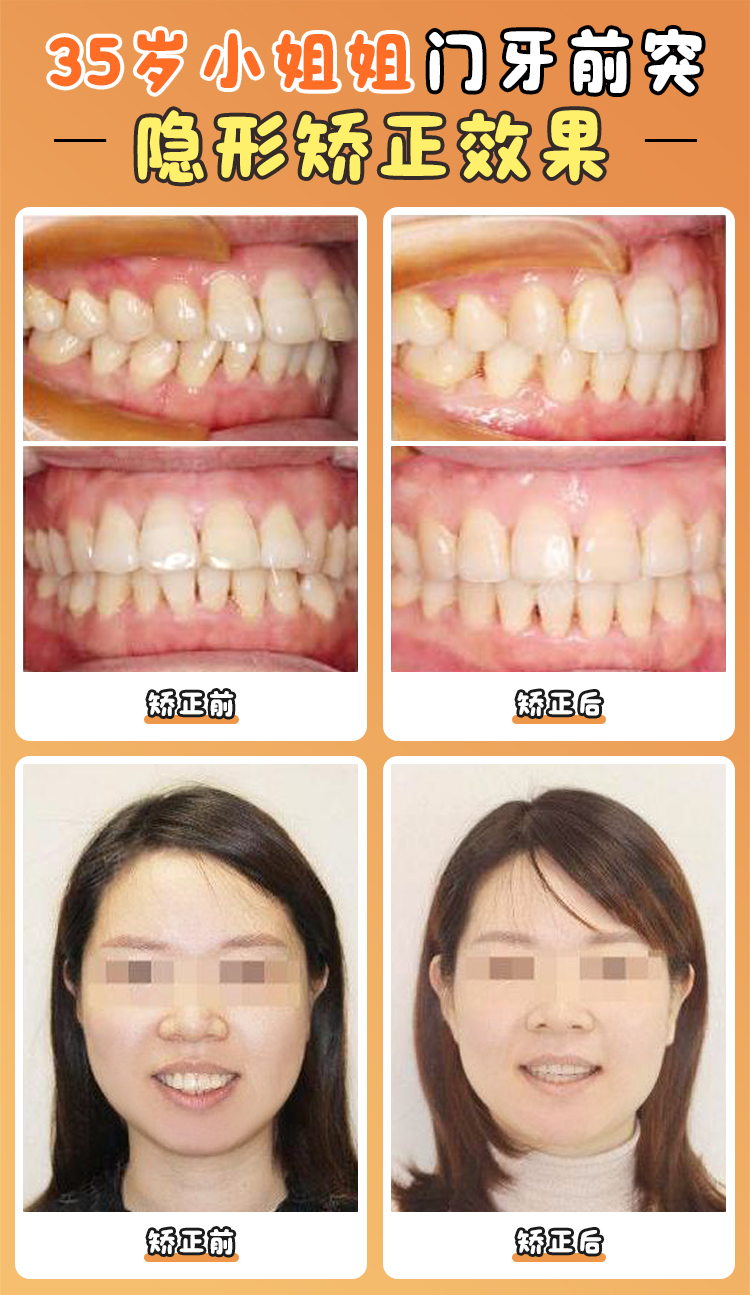 四、张栋梁医生不同难度级别的手术价格