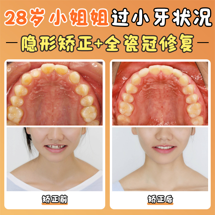 北大口腔醫(yī)院周彥恒怎么掛號(hào)？2025年搶號(hào)全攻略