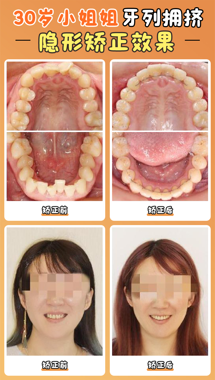 周彥恒醫(yī)生擅長(zhǎng)哪些高難度正畸項(xiàng)目？五大特色技術(shù)全解析