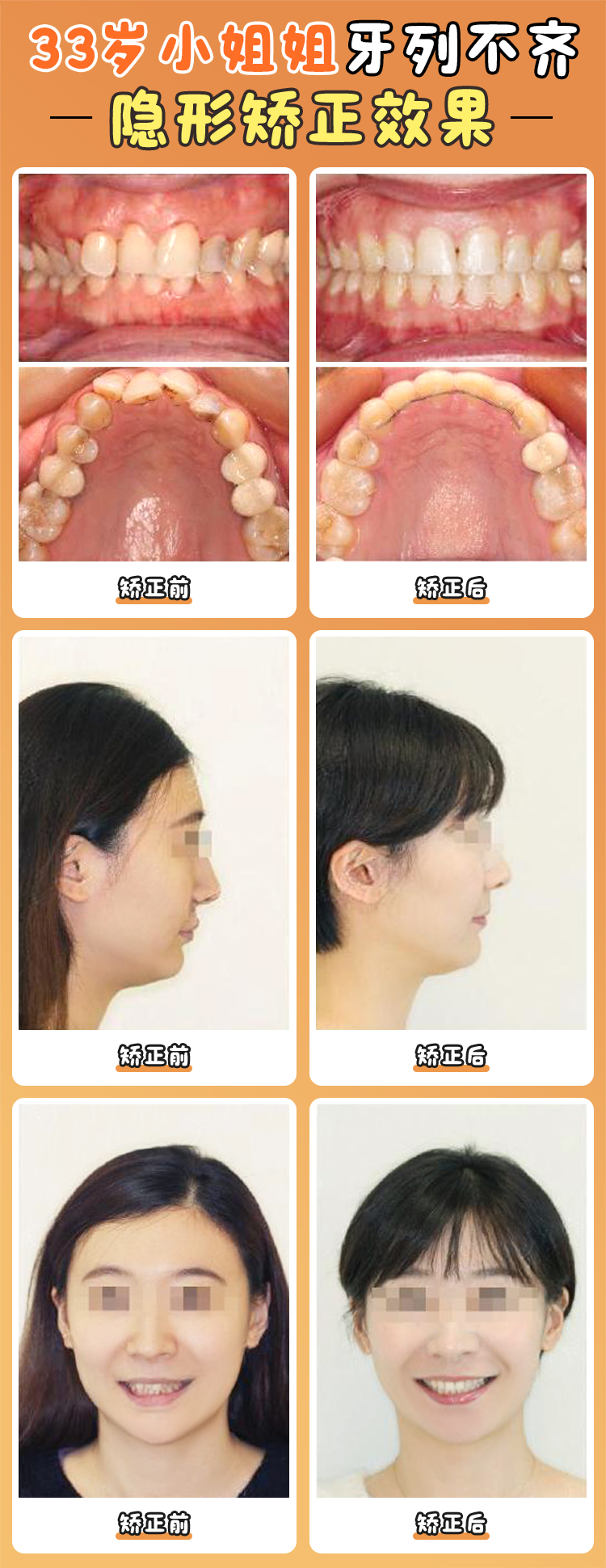 北大口腔周彥恒患者口碑如何？真實(shí)實(shí)例與滿意度測(cè)評(píng)