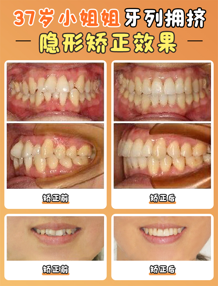 北大口腔周彥恒 vs 其他骨干醫(yī)生：如何判斷是否需要掛他的號(hào)？