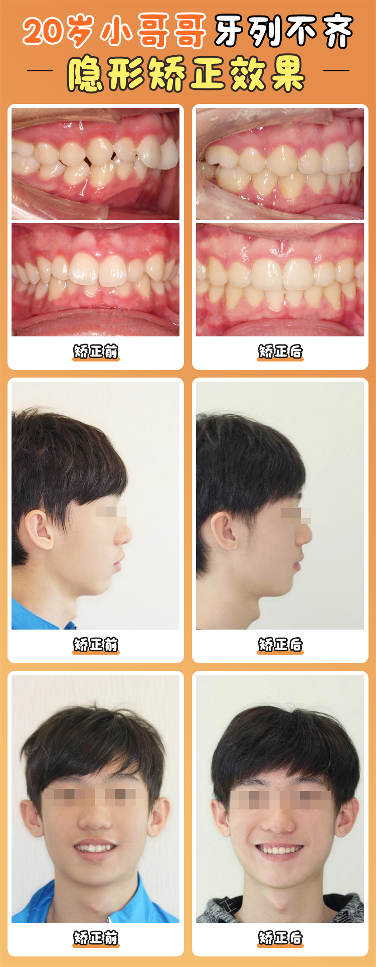 結(jié)尾：選擇周彥恒醫(yī)生的三大理由與就診建議