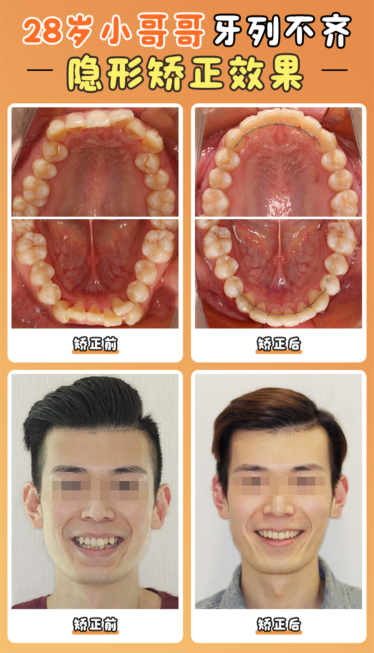 徐寶華醫(yī)生口碑真實反饋：患者眼中的“正畸魔術(shù)師”